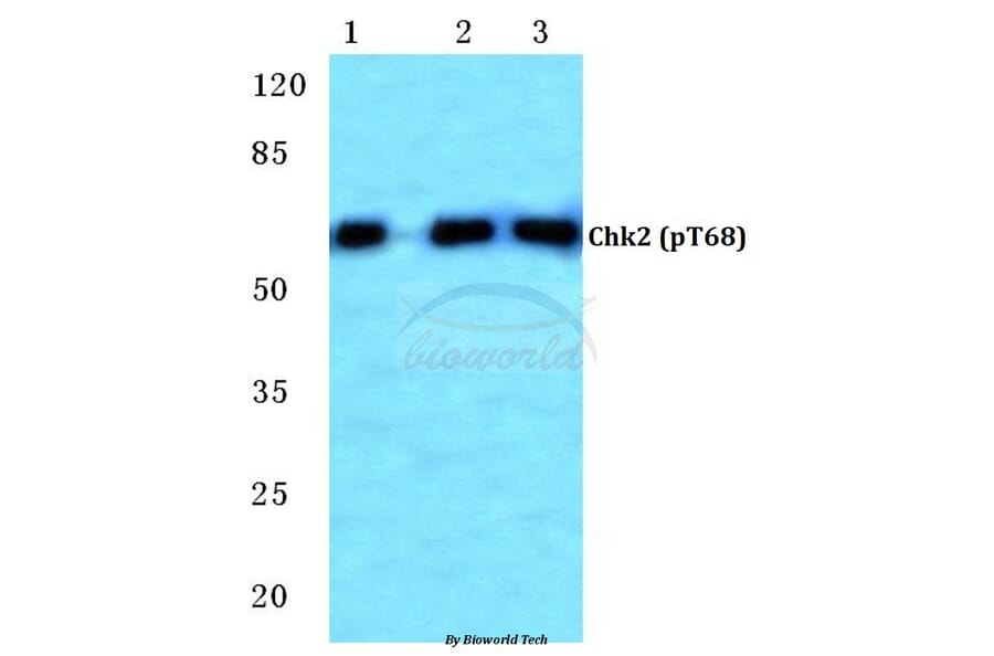 Anti-Chk2 (phospho-T68) Antibody from Bioworld Technology (BS4043) - Antibodies.com