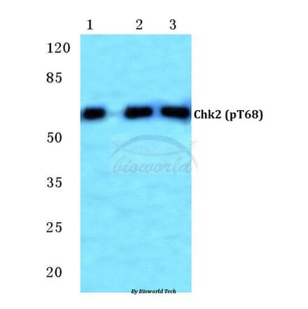 Anti-Chk2 (phospho-T68) Antibody from Bioworld Technology (BS4043) - Antibodies.com