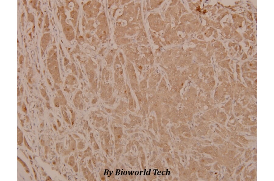 Anti-Chk2 (phospho-T68) Antibody from Bioworld Technology (BS4043) - Antibodies.com