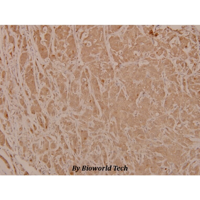 Anti-Chk2 (phospho-T68) Antibody from Bioworld Technology (BS4043) - Antibodies.com
