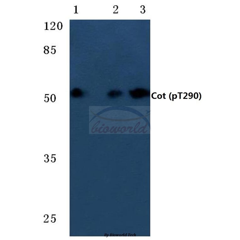 Anti-Cot (phospho-T290) Antibody from Bioworld Technology (BS4051) - Antibodies.com