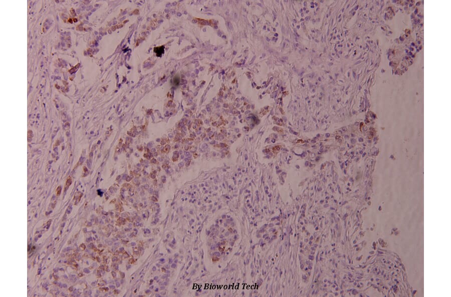 Anti-Cot (phospho-T290) Antibody from Bioworld Technology (BS4051) - Antibodies.com
