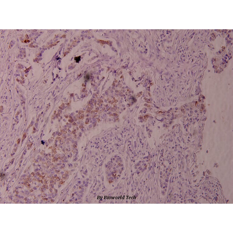 Anti-Cot (phospho-T290) Antibody from Bioworld Technology (BS4051) - Antibodies.com