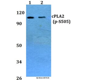 Anti-cPLA2 (phospho-S505) Antibody from Bioworld Technology (BS4052) - Antibodies.com