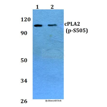 Anti-cPLA2 (phospho-S505) Antibody from Bioworld Technology (BS4052) - Antibodies.com