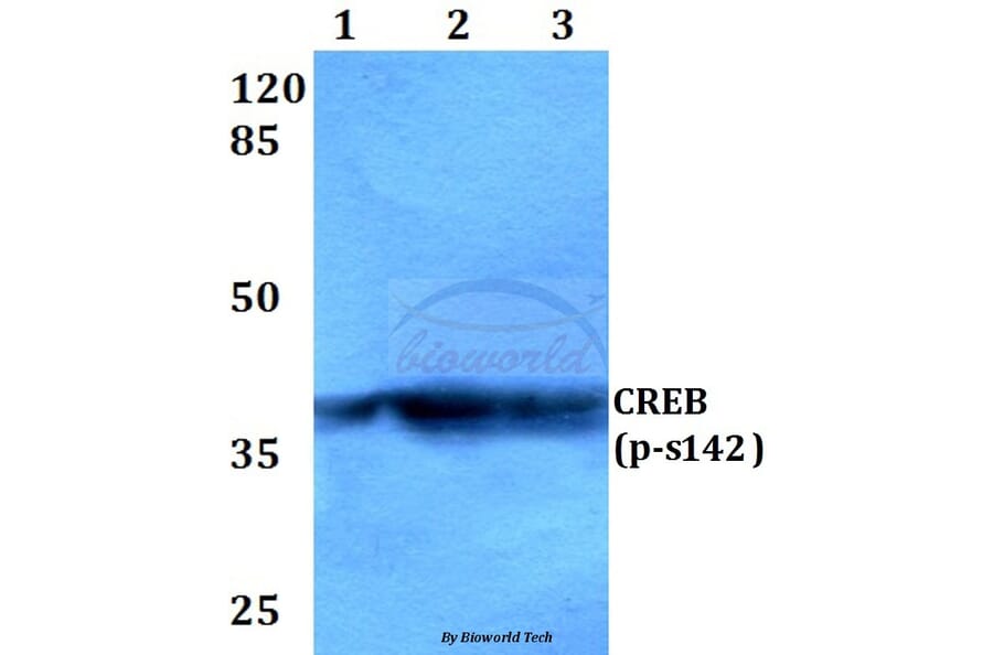 Anti-CREB (phospho-S142) Antibody from Bioworld Technology (BS4054) - Antibodies.com
