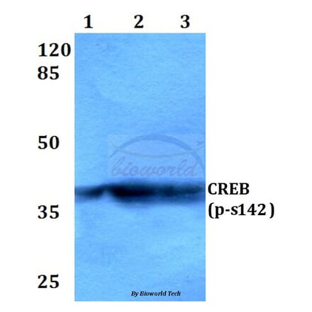 Anti-CREB (phospho-S142) Antibody from Bioworld Technology (BS4054) - Antibodies.com