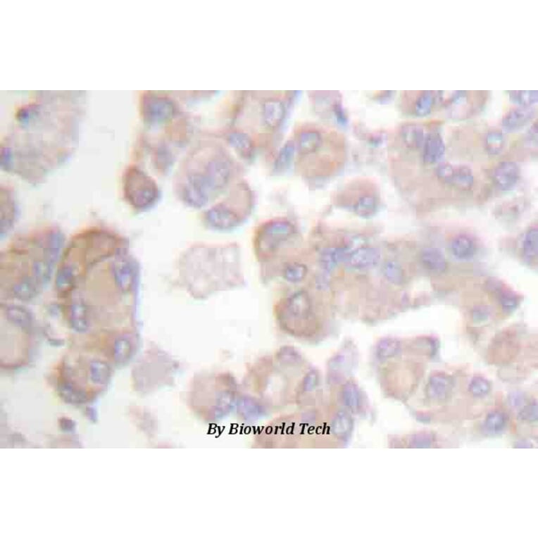 Anti-CrkL (phospho-Y207) Antibody from Bioworld Technology (BS4056) - Antibodies.com