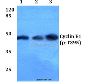 Anti-Cyclin E1 (phospho-T395) Antibody from Bioworld Technology (BS4057) - Antibodies.com