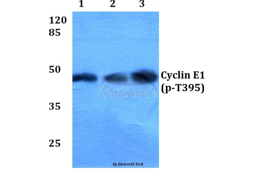 Anti-Cyclin E1 (phospho-T395) Antibody from Bioworld Technology (BS4057) - Antibodies.com