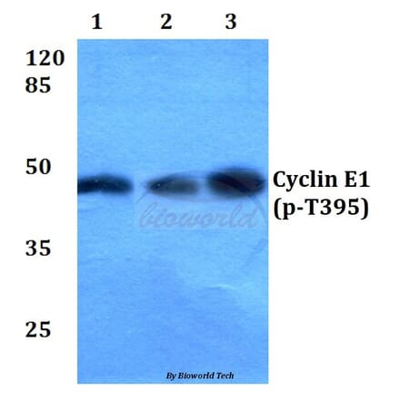 Anti-Cyclin E1 (phospho-T395) Antibody from Bioworld Technology (BS4057) - Antibodies.com