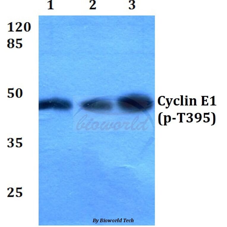 Anti-Cyclin E1 (phospho-T395) Antibody from Bioworld Technology (BS4057) - Antibodies.com