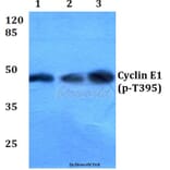 Anti-Cyclin E1 (phospho-T395) Antibody from Bioworld Technology (BS4057) - Antibodies.com