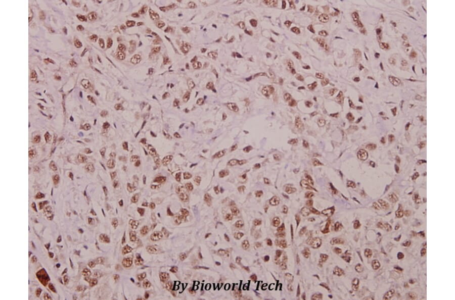 Anti-Cyclin E1 (phospho-T395) Antibody from Bioworld Technology (BS4057) - Antibodies.com