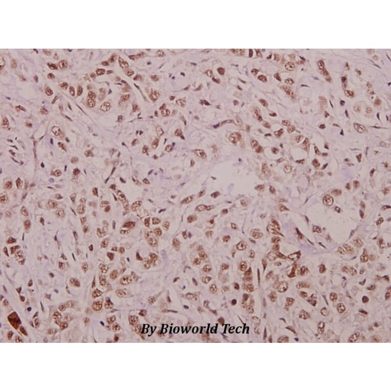 Anti-Cyclin E1 (phospho-T395) Antibody from Bioworld Technology (BS4057) - Antibodies.com