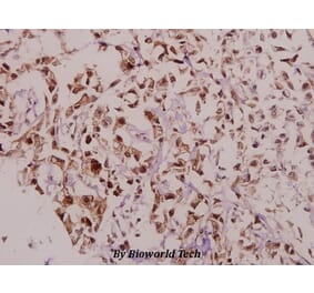 Anti-DARPP-32 (phospho-T75) Antibody from Bioworld Technology (BS4058) - Antibodies.com