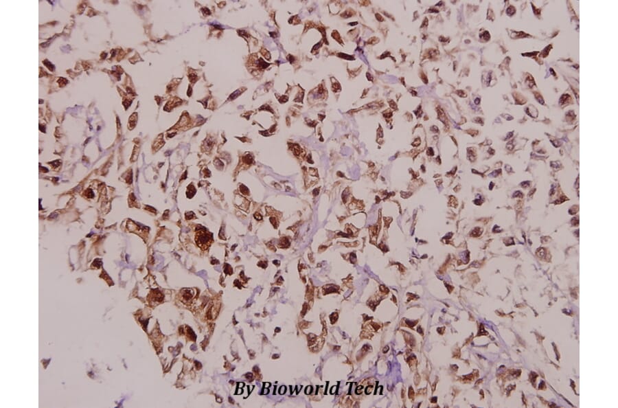 Anti-DARPP-32 (phospho-T75) Antibody from Bioworld Technology (BS4058) - Antibodies.com