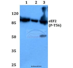 Anti-EEF2 (phospho-T56) Antibody from Bioworld Technology (BS4059) - Antibodies.com