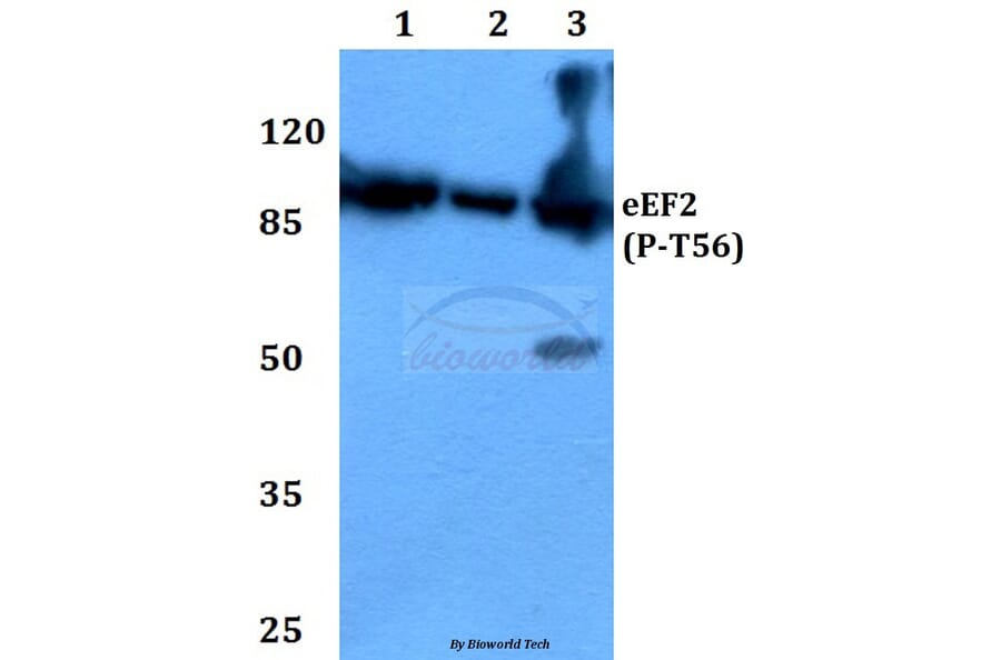 Anti-EEF2 (phospho-T56) Antibody from Bioworld Technology (BS4059) - Antibodies.com