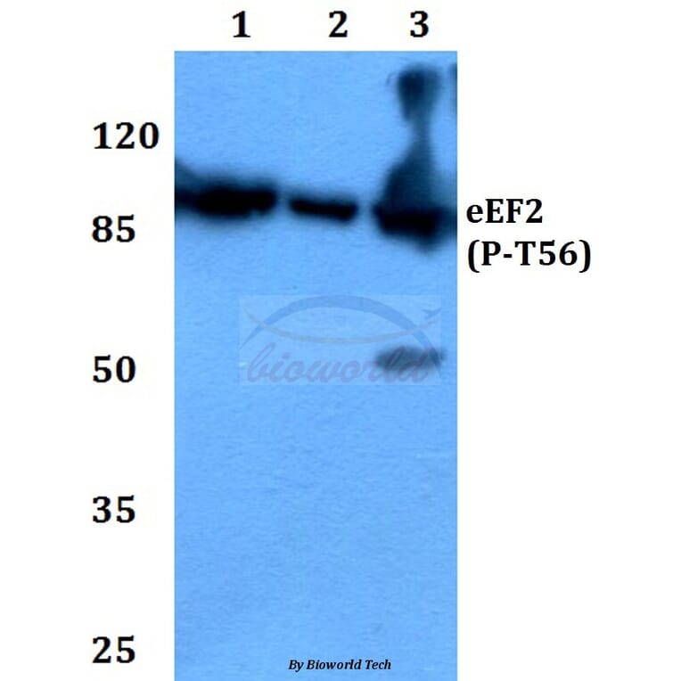 Anti-EEF2 (phospho-T56) Antibody from Bioworld Technology (BS4059) - Antibodies.com
