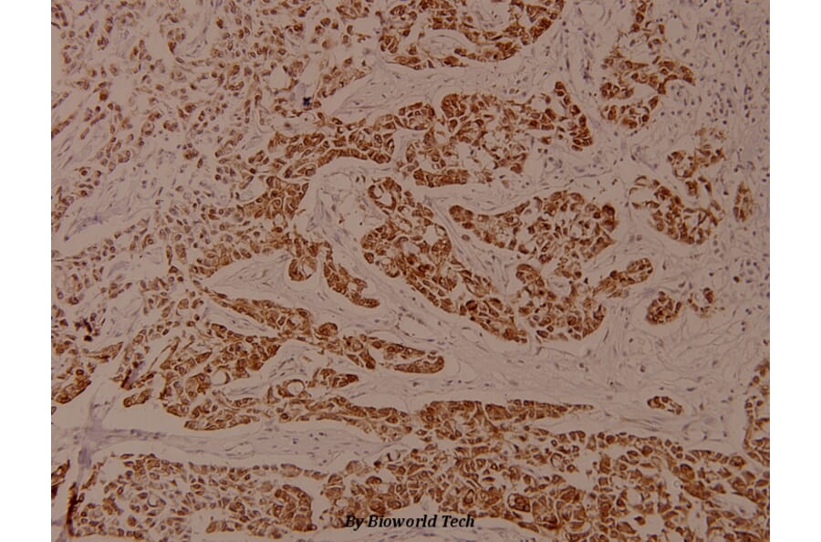 Anti-EEF2 (phospho-T56) Antibody from Bioworld Technology (BS4059) - Antibodies.com