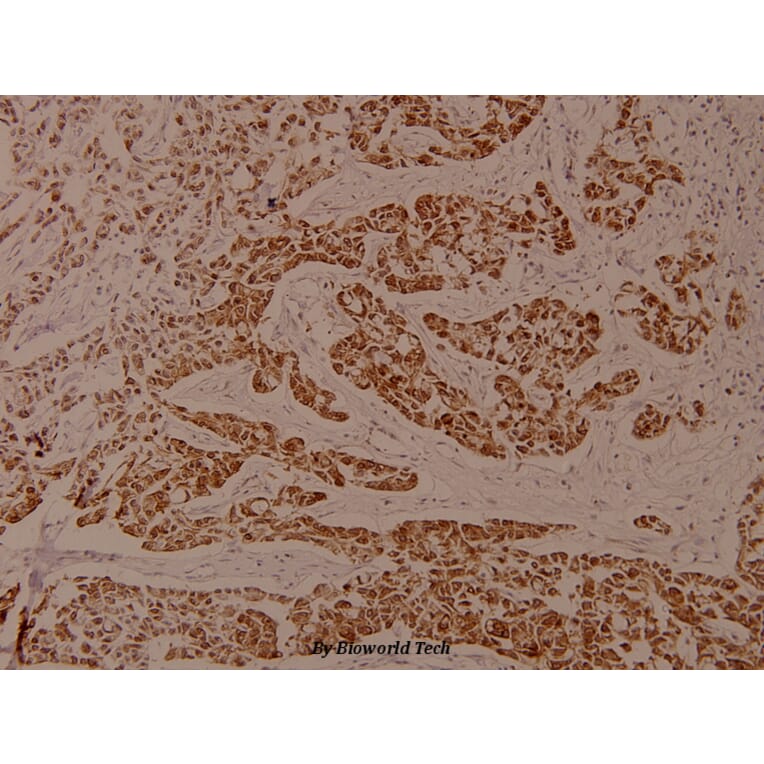 Anti-EEF2 (phospho-T56) Antibody from Bioworld Technology (BS4059) - Antibodies.com