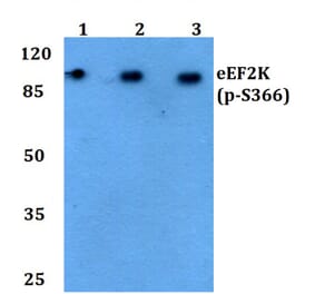 Anti-eEF2K (phospho-S366) Antibody from Bioworld Technology (BS4060) - Antibodies.com