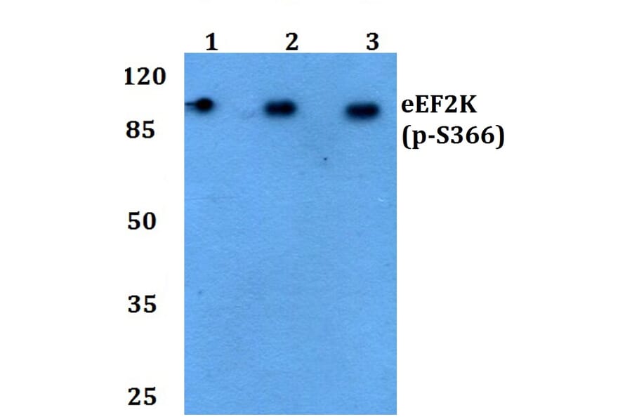 Anti-eEF2K (phospho-S366) Antibody from Bioworld Technology (BS4060) - Antibodies.com