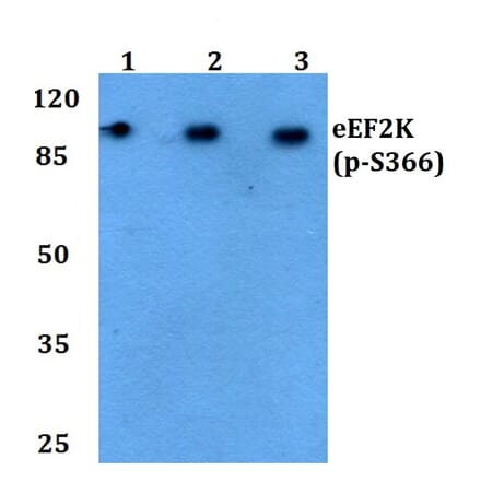 Anti-eEF2K (phospho-S366) Antibody from Bioworld Technology (BS4060) - Antibodies.com