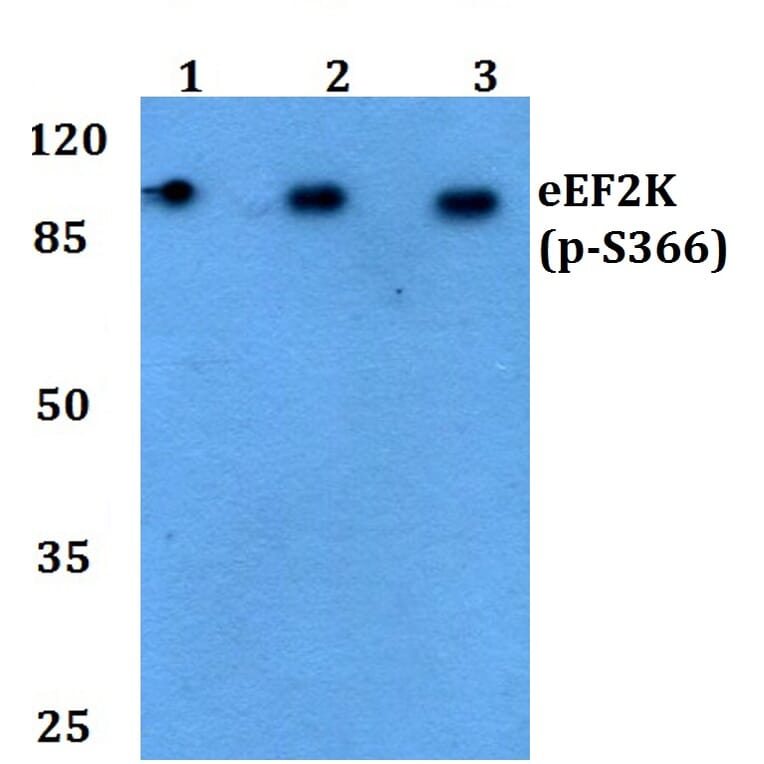Anti-eEF2K (phospho-S366) Antibody from Bioworld Technology (BS4060) - Antibodies.com
