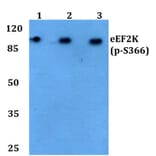 Anti-eEF2K (phospho-S366) Antibody from Bioworld Technology (BS4060) - Antibodies.com