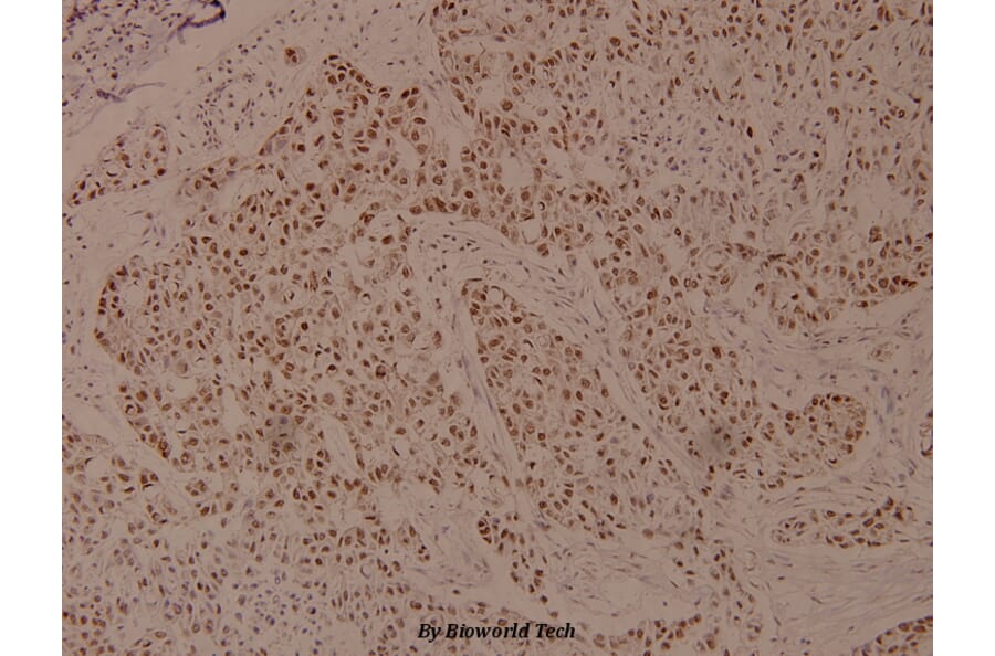 Anti-eEF2K (phospho-S366) Antibody from Bioworld Technology (BS4060) - Antibodies.com