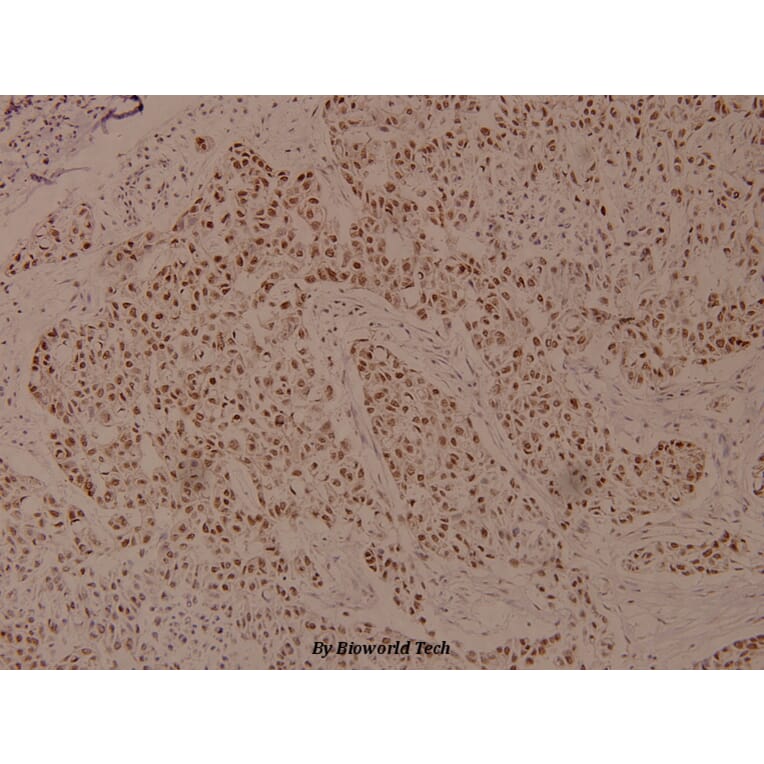 Anti-eEF2K (phospho-S366) Antibody from Bioworld Technology (BS4060) - Antibodies.com
