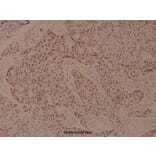 Anti-eEF2K (phospho-S366) Antibody from Bioworld Technology (BS4060) - Antibodies.com