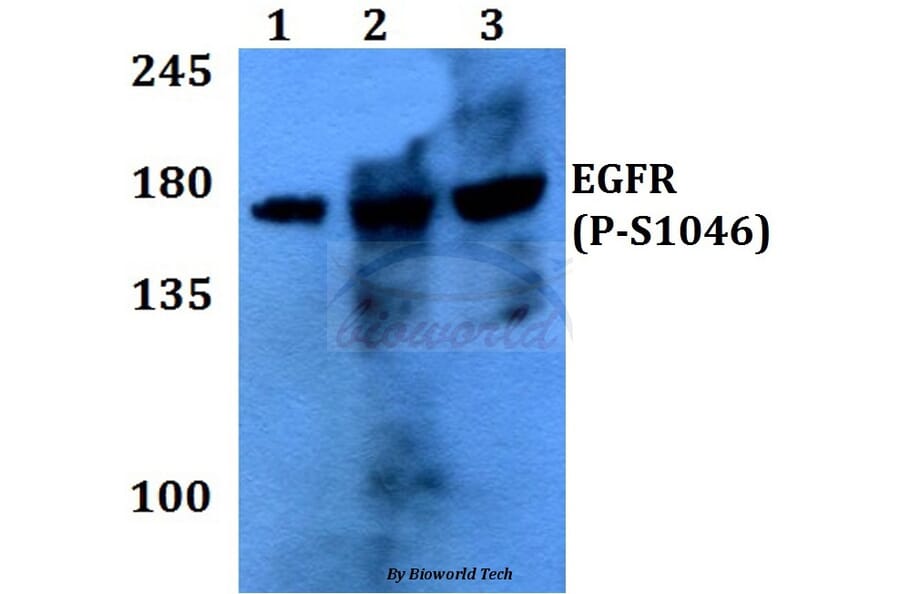 Anti-EGFR (phospho-S1046) Antibody from Bioworld Technology (BS4061) - Antibodies.com