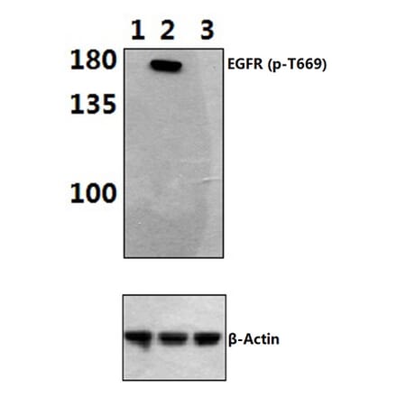 Anti-EGFR (phospho-T669) Antibody from Bioworld Technology (BS4063) - Antibodies.com