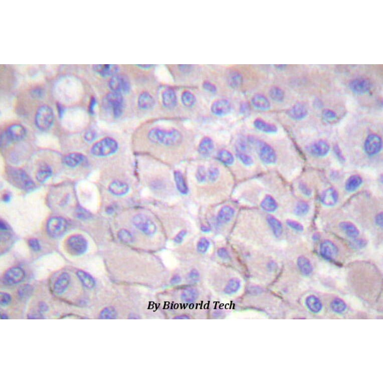 Anti-EGFR (phospho-T669) Antibody from Bioworld Technology (BS4063) - Antibodies.com