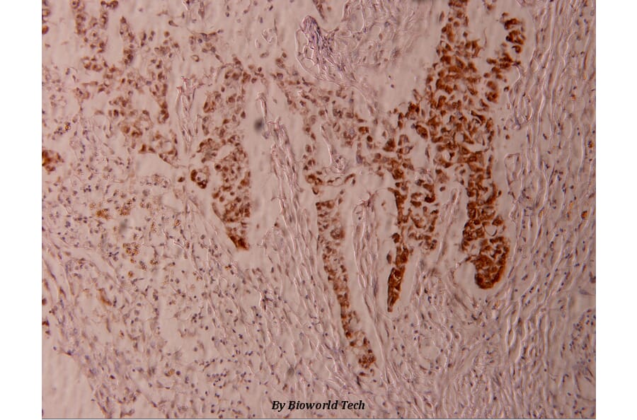 Anti-Elk1 (phospho-S383) Antibody from Bioworld Technology (BS4065) - Antibodies.com
