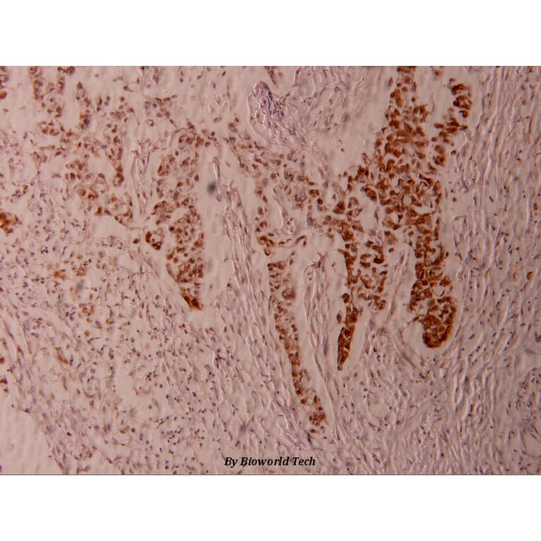 Anti-Elk1 (phospho-S383) Antibody from Bioworld Technology (BS4065) - Antibodies.com