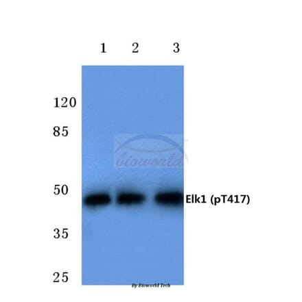 Anti-Elk1 (phospho-T417) Antibody from Bioworld Technology (BS4067) - Antibodies.com