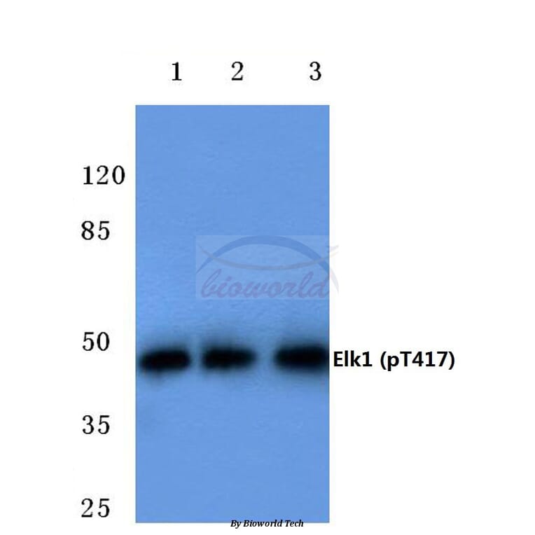 Anti-Elk1 (phospho-T417) Antibody from Bioworld Technology (BS4067) - Antibodies.com