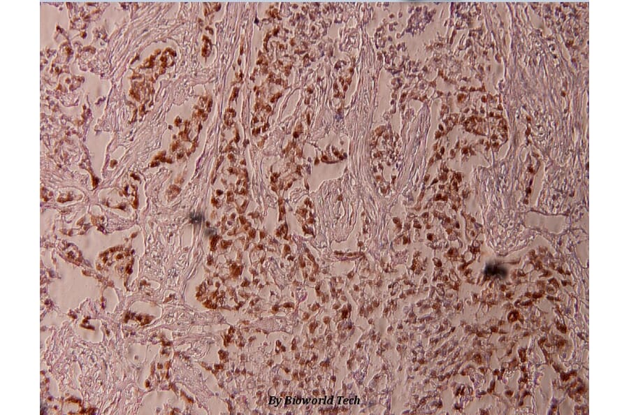 Anti-Elk1 (phospho-T417) Antibody from Bioworld Technology (BS4067) - Antibodies.com