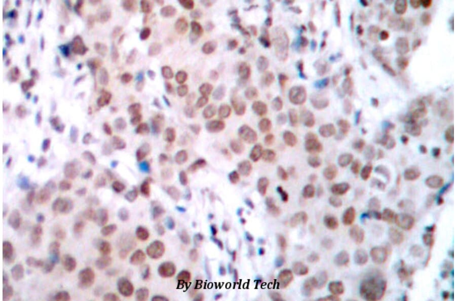 Anti-ERα (phospho-S104) Antibody from Bioworld Technology (BS4069) - Antibodies.com