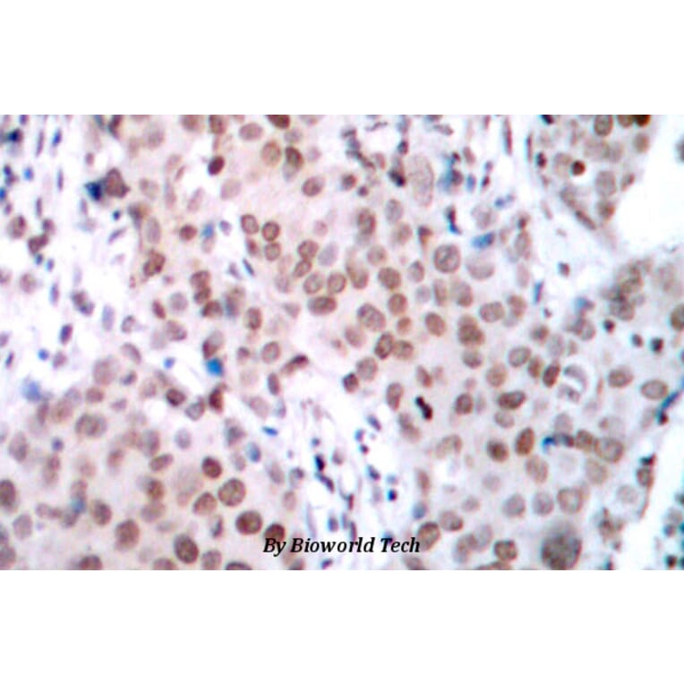 Anti-ERα (phospho-S104) Antibody from Bioworld Technology (BS4069) - Antibodies.com