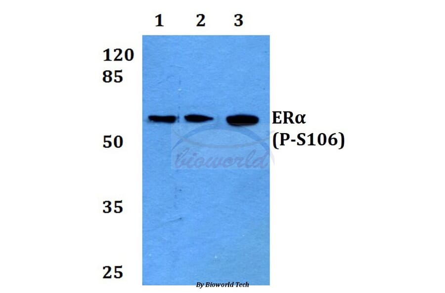 Anti-ERα (phospho-S106) Antibody from Bioworld Technology (BS4070) - Antibodies.com