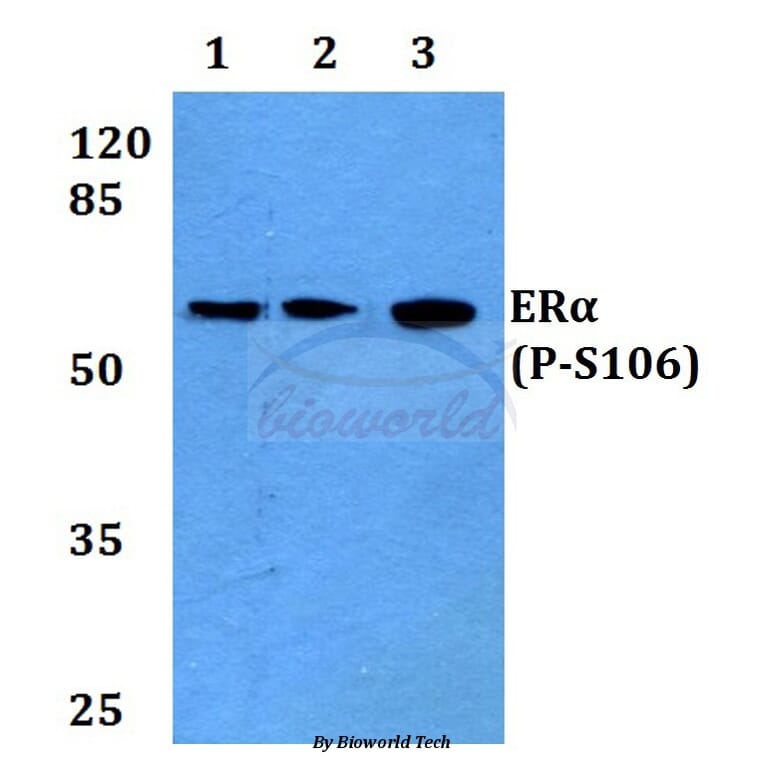 Anti-ERα (phospho-S106) Antibody from Bioworld Technology (BS4070) - Antibodies.com