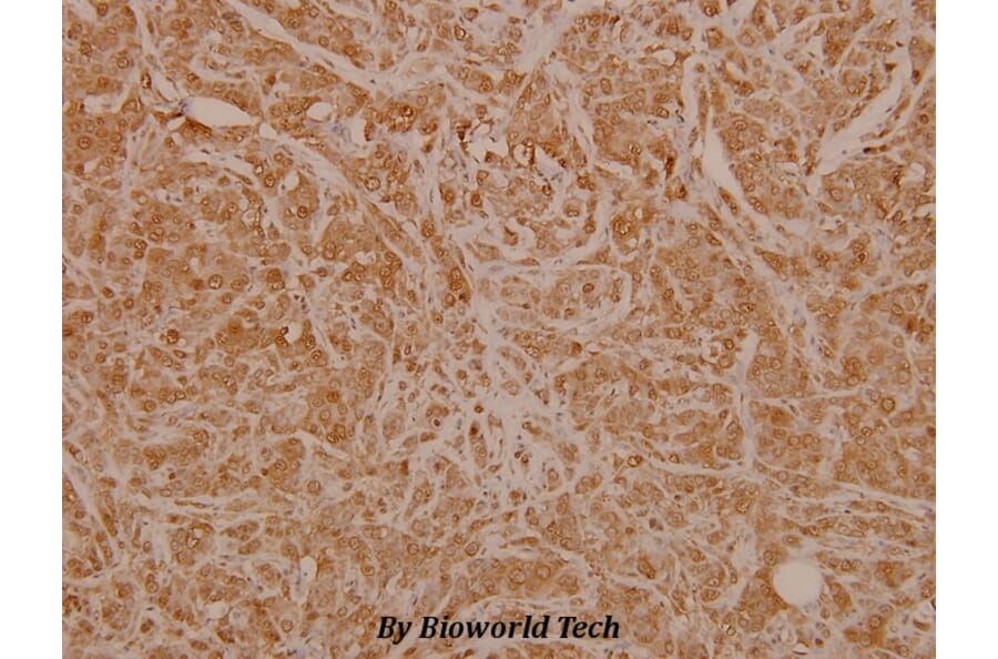 Anti-ERα (phospho-S106) Antibody from Bioworld Technology (BS4070) - Antibodies.com