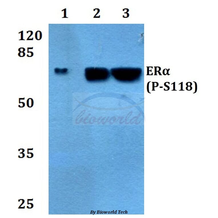 Anti-ERα (phospho-S118) Antibody from Bioworld Technology (BS4071) - Antibodies.com