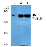 Anti-ERα (phospho-S118) Antibody from Bioworld Technology (BS4071) - Antibodies.com