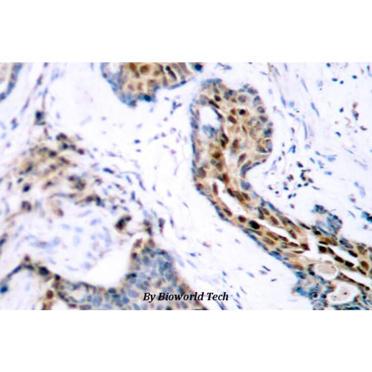 Anti-ERα (phospho-S118) Antibody from Bioworld Technology (BS4071) - Antibodies.com